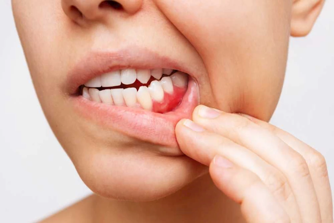 لكبار السن – 4 أسباب لتغير شكل أسنانك ولثتك