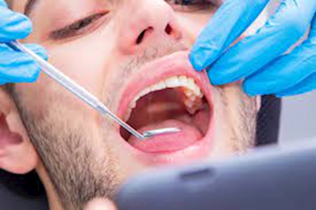 اخلع ضرس العقل فورًا بعد ظهور هذه العلامات