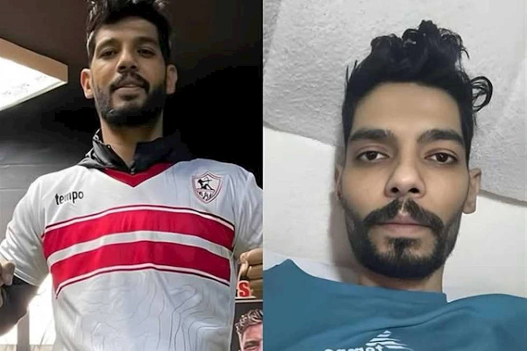 مرض إبراهيم شيكا.. إليك أعراضه وأسبابه