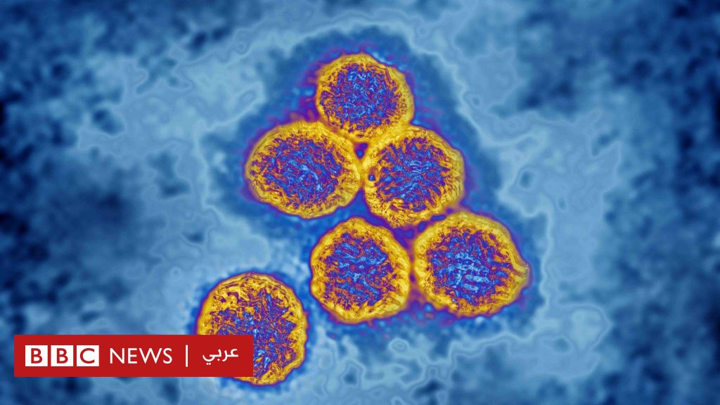 ما الذي نعرفه عن الحمة النزفية بعد تسجيل إصابات جديدة في العراق؟