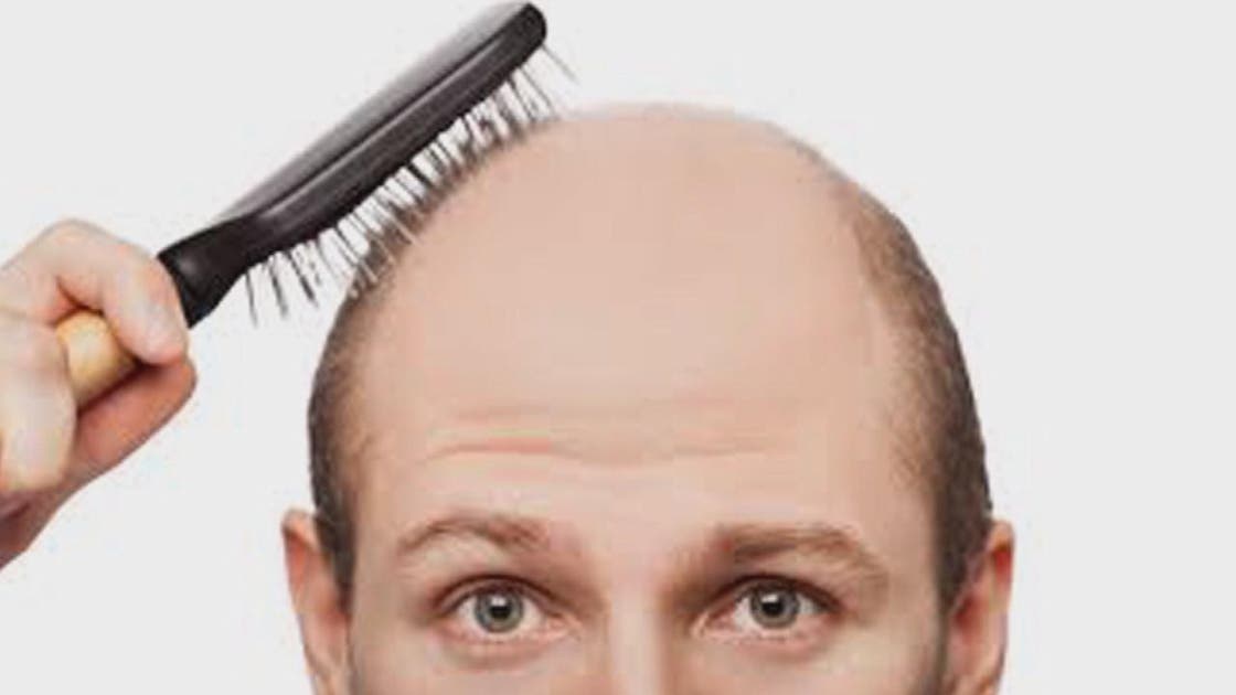 وداعًا للصلع وزراعة الشعر.. العلماء يكتشفون البروتين المعجزة