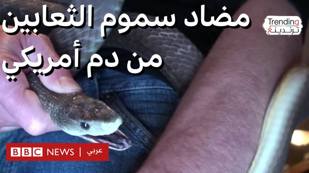 فيديو, كيف استفاد العلماء من دم أمريكي حقن نفسه بسم الثعابين ولدغاتها مئات المرات؟ وماذا تفعلون لو تعرضتم للدغة أفعى؟, المدة 8,31