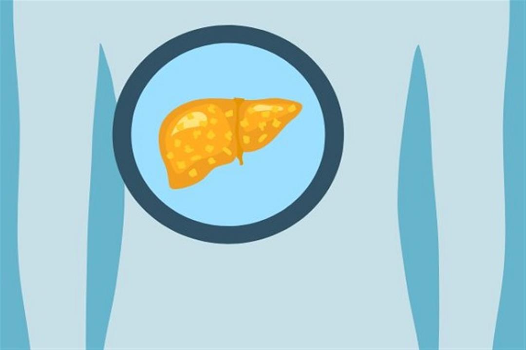 سهل التحضير- تناول هذا المشروب لعلاج دهون الكبد