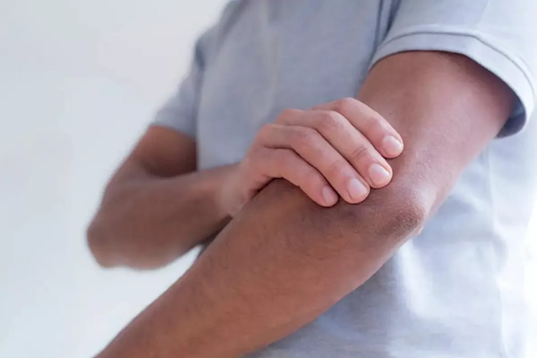 انتبه- تنميل الذراع اليسرى علامة على هذه الأمراض