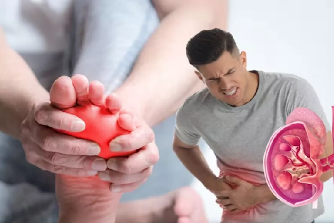 تظهر على القدمين- 5 أعراض لتليف الكلى احذرها