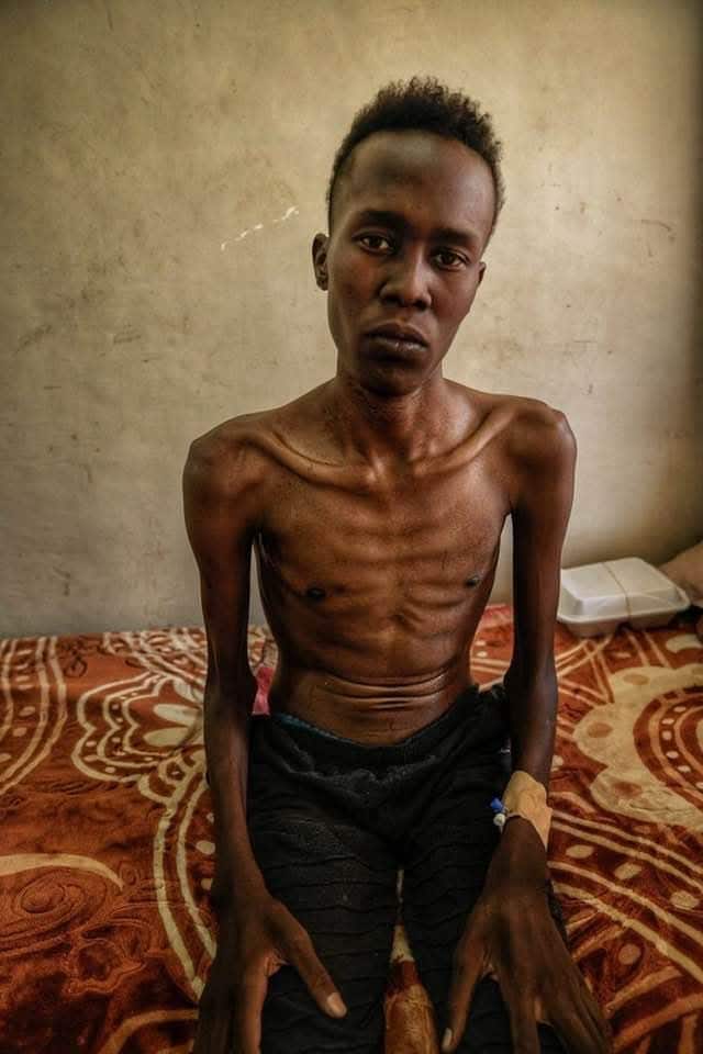 المليشيا حولته إلى هيكل عظمي وأمه لم تتعرف عليه.. مأساة شاب عذبـ.ـوه 18 شهرًا