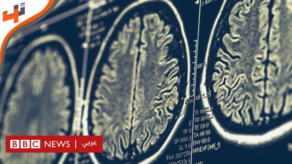 فيديو, استنبات خلايا دماغ من أعضاء الجسم, المدة 5,13