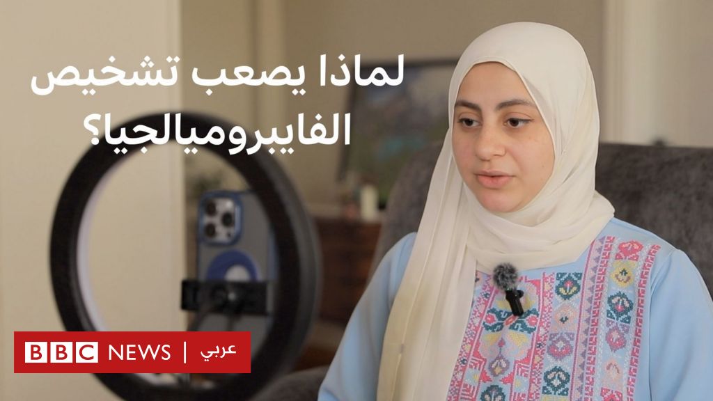 فيديو, في اليوم العالمي للمرض، لماذا يصعب تشخيص الفايبروميالجيا؟, المدة 3,06