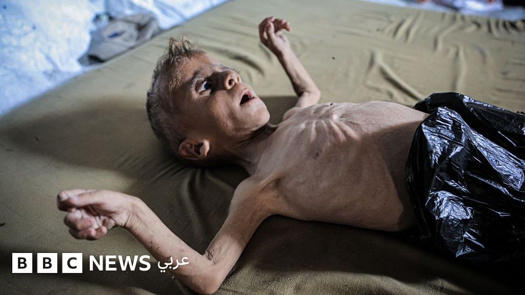 هل تكفي الإدانات الدولية لوقف المجاعة في غزة؟