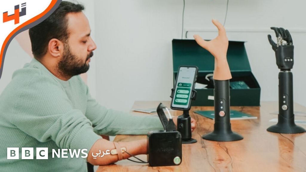 فيديو, أطراف اصطناعية ذكية باستخدام التكنولوجيا المتقدمة, المدة 4,59