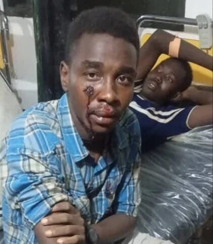 اشتباكات دامية بين لاجئين سودانيين وجنوبيين في أوغندا ومطالب بإعلان “الطوارئ”