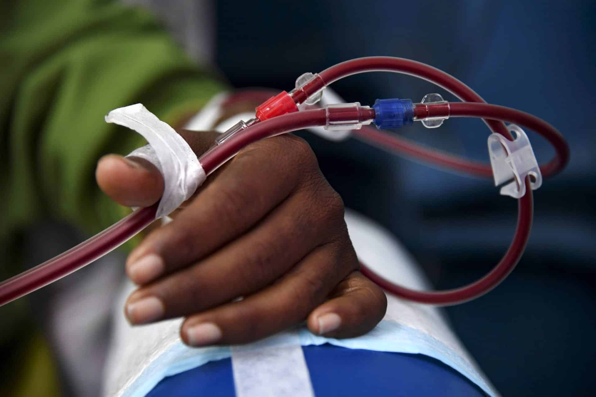 5 علامات مبكرة خفية لمرض التصلب اللويحي